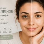 dunkle Augenringe